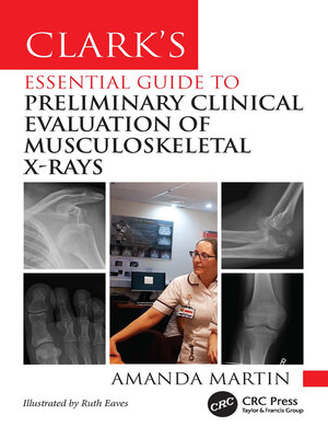 cover image of Clark's Essential Guide to Musculoskeletal X-Ray Interpretation for Radiographers